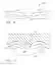 Fig. 06 - Surgical staples comprising features for improved fastening of tissue