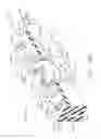 Fig. 22 - Surgical staples comprising features for improved fastening of tissue