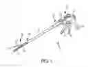 Fig. 02 - Surgical adjuncts with medicants affected by activators
