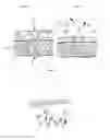 Fig. 07 - Adjunct material to promote tissue growth in a colon