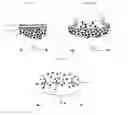 Fig. 08 - Adjunct material to promote tissue growth in a colon