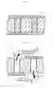 Fig. 09 - Adjunct material to promote tissue growth in a colon