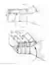 Fig. 20 - Adjunct material to promote tissue growth in a colon