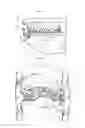Fig. 32 - Adjunct material to promote tissue growth in a colon