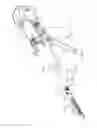 Fig. 02 - Surgical staple configurations with camming surfaces located between portions supporting surgical staples