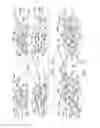 Fig. 15 - Surgical staple configurations with camming surfaces located between portions supporting surgical staples