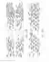 Fig. 18 - Surgical staple configurations with camming surfaces located between portions supporting surgical staples