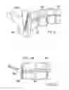 Fig. 06 - Surgical string applicator for anastomosis surgery and method of use