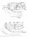Fig. 08 - Surgical string applicator for anastomosis surgery and method of use