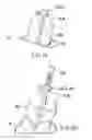 Fig. 17 - Surgical string applicator for anastomosis surgery and method of use