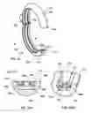 Fig. 19 - Surgical string applicator for anastomosis surgery and method of use