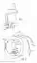 Fig. 02 - Detection and treatment of abnormal upper esophageal sphincter functionality