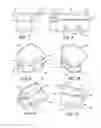 Fig. 04 - Device and method for allografting