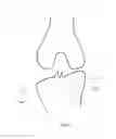 Fig. 15 - Tibial Guides, Tools, and Techniques for Resecting the Tibial Plateau