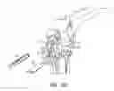 Fig. 10 - Tibial resection systems and methods for cruciate ligament retainment