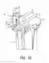 Fig. 12 - Tibial resection systems and methods for cruciate ligament retainment