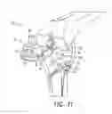 Fig. 13 - Tibial resection systems and methods for cruciate ligament retainment