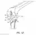 Fig. 14 - Tibial resection systems and methods for cruciate ligament retainment