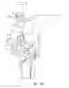 Fig. 16 - Tibial resection systems and methods for cruciate ligament retainment
