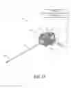 Fig. 18 - Systems for treating a vertebral body