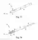 Fig. 11 - Medical instrument set and method of use for treating bony aberrations of the calcaneus