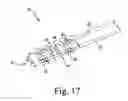Fig. 12 - Medical instrument set and method of use for treating bony aberrations of the calcaneus