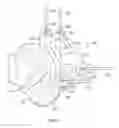 Fig. 02 - Patient-specific orthopedic instruments