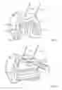 Fig. 04 - Patient-specific orthopedic instruments