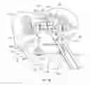 Fig. 10 - Patient-specific orthopedic instruments