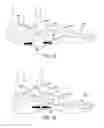 Fig. 09 - Method and cut guide for biplanar wedge osteotomy