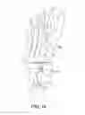 Fig. 10 - Method and cut guide for biplanar wedge osteotomy