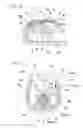 Fig. 10 - Stone extraction and fragmentation device
