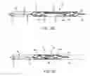 Fig. 04 - Retrieval apparatus and methods for use