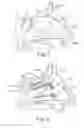 Fig. 06 - Apparatus and method to secure turbinate to nasal septum