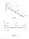 Fig. 07 - Apparatus and method to secure turbinate to nasal septum