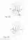 Fig. 13 - Apparatus and method to secure turbinate to nasal septum