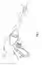 Fig. 02 - Surgical apparatus