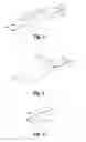 Fig. 04 - Surgical apparatus