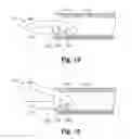 Fig. 11 - Surgical apparatus