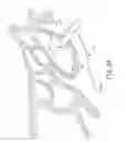 Fig. 03 - Apparatus to form opening in ethmoid bulla and irrigate ethmoid sinus cavity