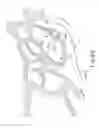 Fig. 04 - Apparatus to form opening in ethmoid bulla and irrigate ethmoid sinus cavity