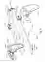 Fig. 08 - Apparatus to form opening in ethmoid bulla and irrigate ethmoid sinus cavity