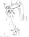 Fig. 31 - Apparatus to form opening in ethmoid bulla and irrigate ethmoid sinus cavity