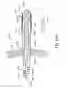 Fig. 40 - Apparatus to form opening in ethmoid bulla and irrigate ethmoid sinus cavity