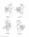 Fig. 19 - Adjunct material for delivery to stomach tissue