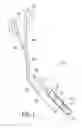 Fig. 02 - CATHETER EXTRACTION