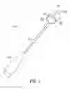 Fig. 04 - CATHETER EXTRACTION