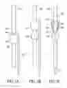 Fig. 06 - CATHETER EXTRACTION