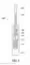 Fig. 07 - CATHETER EXTRACTION