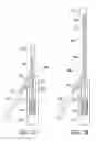 Fig. 08 - CATHETER EXTRACTION